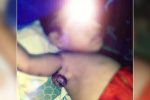 Sulit Dapat Surat Keterangan Miskin, Pasien Balita Tumor Jinak di Alor Terlantar Pasien Fiana Soares Maggi yang divonis dokter terserang lipoma atau tumor jinak di bawah bahu kanannya.