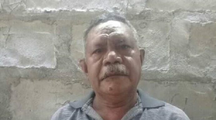 Keluarga Bantah Hasil Rapid Test Pasien Meninggal di RSD Kalabahi Reaktif Covid-19 Kakak Almarhum SL, Salmon Langmau. (Foto: doc tribuanapos.net).
