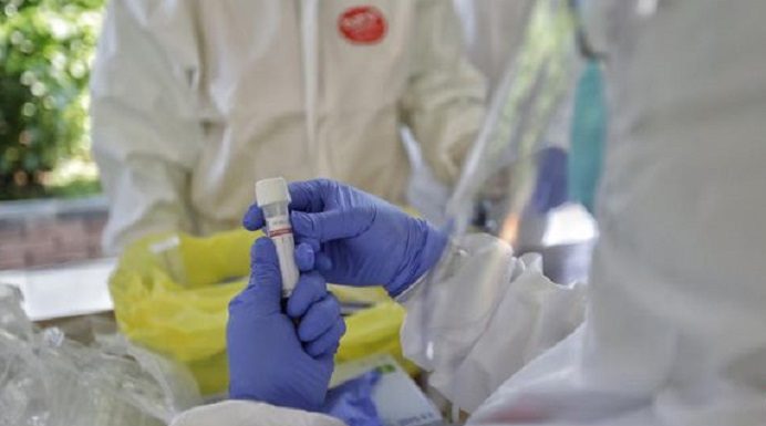 Breaking News: Alor Tambah 8 Kasus Covid-19, Total 56 Gambar: Ilustrasi hasil test swab. (Foto: cnnindonesia.com).