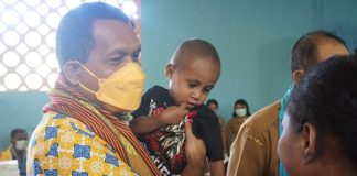 Berantas Stunting, Laka Lena Sambangi Penderita Balita Beri Asupan Gizi di TTU